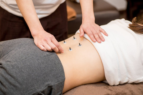 お灸をする女性