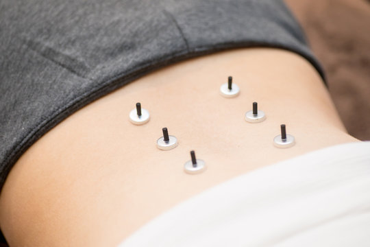 お灸をする女性