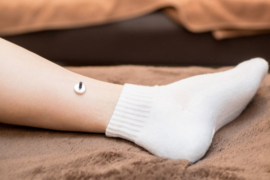 お灸をする女性