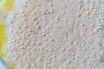 Colony characteristic of Actinomyces, Bacteria, yeast and Mold on selective media from soil samples for study in laboratory microbiology.