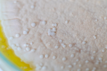 Colony characteristic of Actinomyces, Bacteria, yeast and Mold on selective media from soil samples for study in laboratory microbiology.