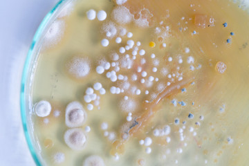 Colony characteristic of Actinomyces, Bacteria, yeast and Mold on selective media from soil samples for study in laboratory microbiology.