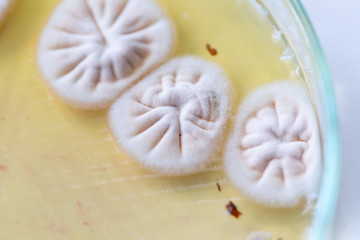 Colony characteristic of Actinomyces, Bacteria, yeast and Mold on selective media from soil samples for study in laboratory microbiology.
