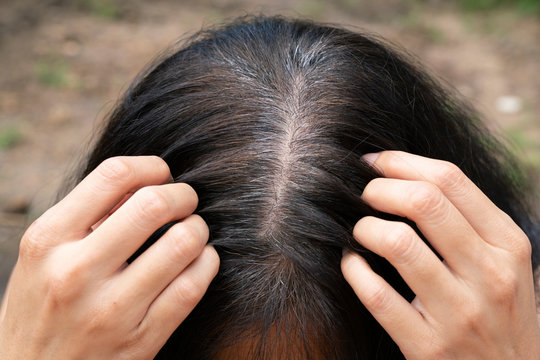 Young Woman Shows Her Gray Hair Roots