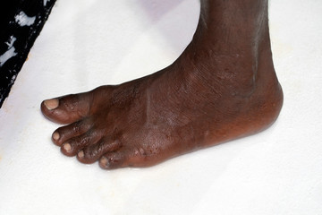 foot of black Migrant detail on boat