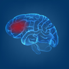 isolate of 3D of human brain with migraine headache image in digital blue background. concept for MRI scan for medical healthcare or human body scientific in vector illustration