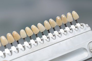 Close up of shade guide to check veneer of tooth crown in a dental laboratory