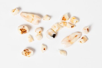 Caries on primary tooth - clean your teeth carefully - visit dentist regularly.