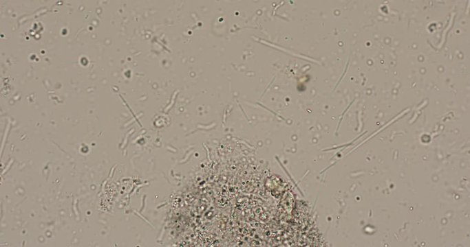Bacteria type in wastewater under the microscope in laboratory.