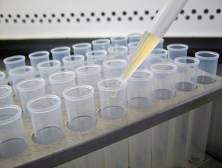 Science equipment : microbiology media in test tube