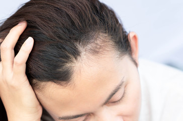 Fototapeta premium Woman serious hair loss problem for health care shampoo and beauty product concept