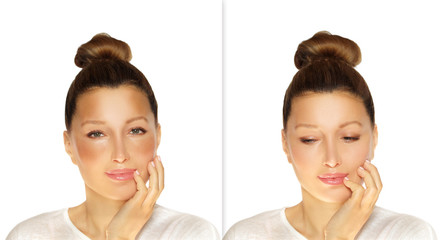 Dark spots, freckles,hyperpigmentation(melasma or chloasma)