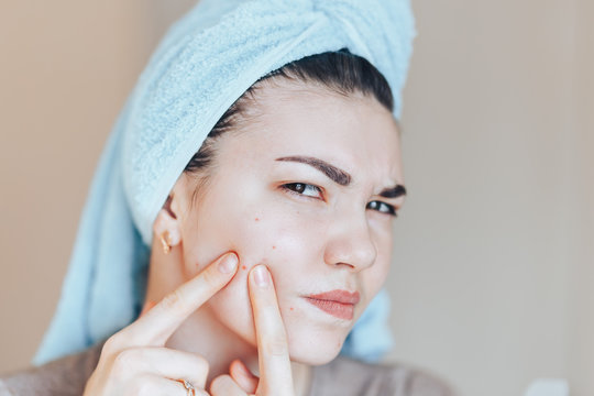 Teenage girl squeezing her pimples, removing pimple from her face. Woman skin care concept photos of ugly problem skin girl on beige background.