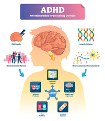 ADHD vector illustration. Labeled mind attention deficit disorder scheme. - obrazy, fototapety, plakaty