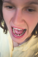 Photo of crooked woman teeth