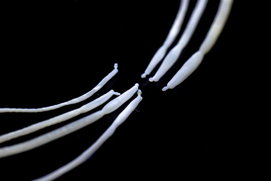 The study of Acanthocephala is a phylum of parasitic worms known as acanthocephalans, thorny-headed worms or spiny-headed worms in laboratory.