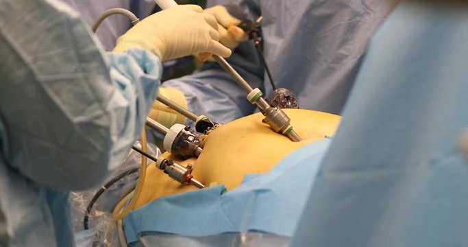 Laparoscopic Surgery
