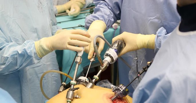 Laparoscopic Surgery