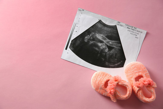 Ultrasound picture and baby shoes on color background, top view with space for text