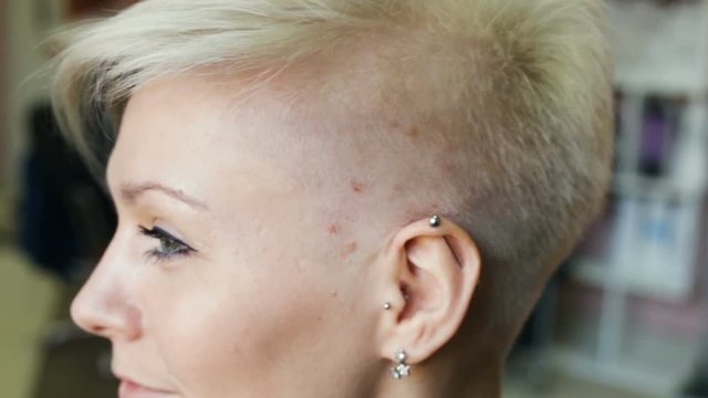 An attractive girl stands sideways to the camera, showing red blisters on the scalp. Allergic reaction to chemical staining and discoloration of the hair. Profile, real time, natural light, close-up, 