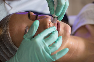 Closeup view of female face getting facial cleansing or dermabrasion treatment.