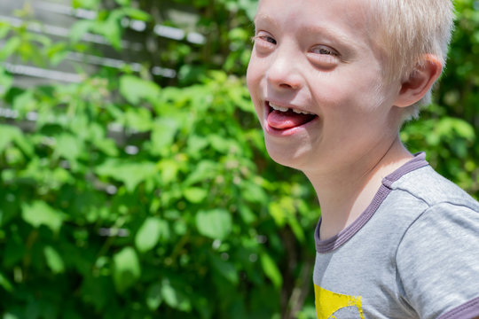 Defect,childcare,medicine and people concept: Happy and smiling boy with down syndrome while playing in the garden.