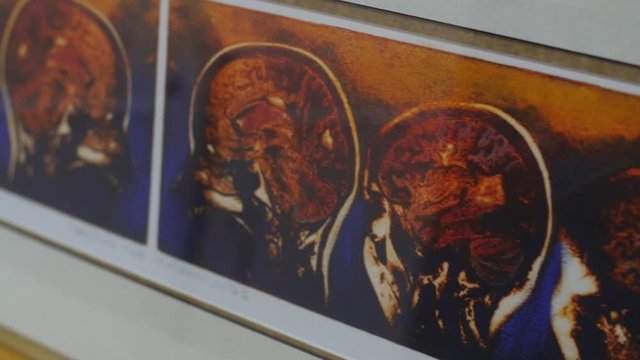 background of brain scan images