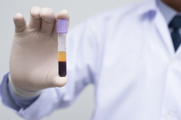 Male doctor showing  centrifuge blood test tube