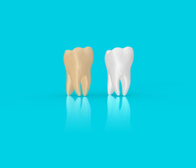 Tooth Concept Yellow vs White 3D Rendering