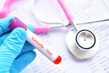 Blood sample tube for chickenpox or varicella virus test
