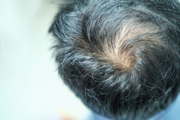 Bold in the middle head and begin no lose hair of mature Asian business smart active office man.