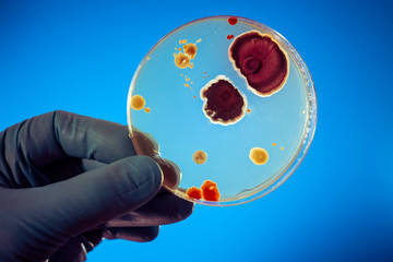 petri dish with microbe colony in doctor hand