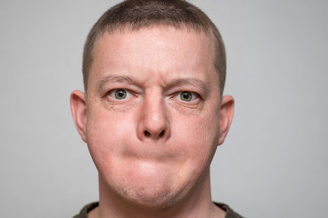 Serious young man without a mouth. Face of young man without mouth. Censorship concept