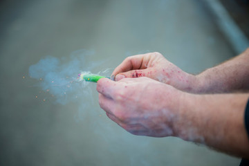 detail of burned injured mans hands after handling fireworks wrong way