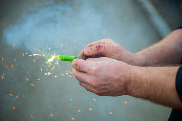 fireworks expotion in mans hands causing burns and injury