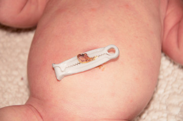 Umbilical cord with clamp of newborn baby close-up