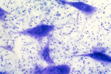 Neurons cells from the brain under the microscope view.
