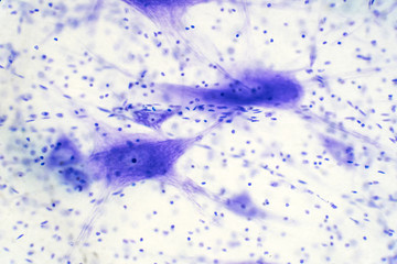 Neurons cells from the brain under the microscope view.