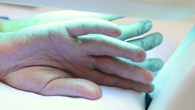 hands of a patient with psoriasis close-up under an ultraviolet lamp. Light therapy, phototherapy