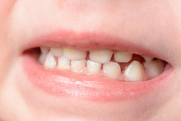 Fototapeta premium Little baby's teeth are shot at the macro when she laughs