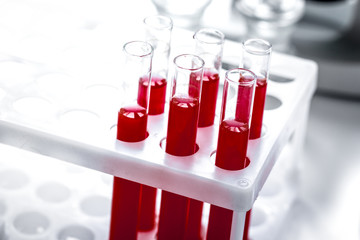 glass tubes with blood sample in stand no one