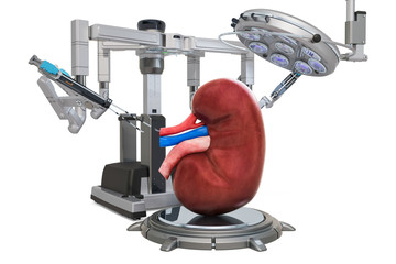 Robotic surgery of the kidney concept, 3D rendering