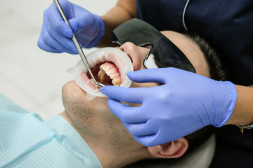 A female dentist examines the oral cavity of the patient with a tool with a mirror. Close-up portrait of a patient with a mouth open, a doctor in gloves holds a dental mirror.