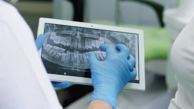 Dentist looking at human teeth X-ray on the digital tablet.