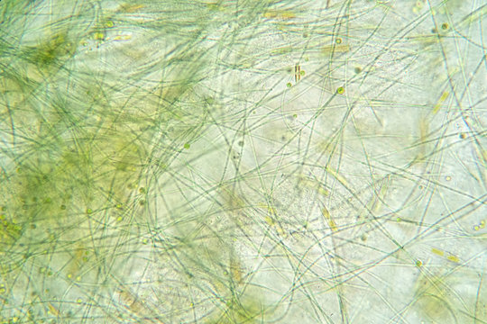 Filamentous algae are single algae cells that form long visible chains.