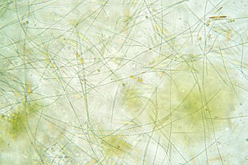 Filamentous algae are single algae cells that form long visible chains.