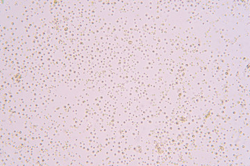 Chlorella is a genus of single-celled green.