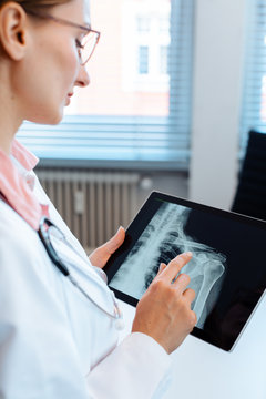 Doctor looking at x-ray picture of a shoulder on her tablet computer