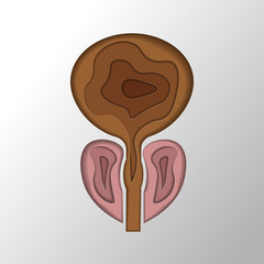 normal prostate and acute prostatitis. Medical illustration paper cut style