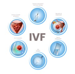 In Vitro Fertilization Infographics Round Icons